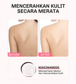 Lavojoy Let It Glow Body Serum Skin Brightening Upgraded Version | Body Lotion Untuk Mencerahkan Dan Melembabkan Kulit Dengan Niacinamide + Ceramide + Vitamin E