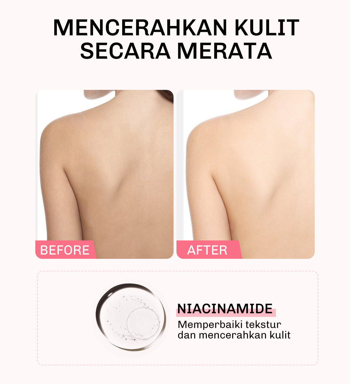 Lavojoy Let It Glow Body Serum Skin Brightening Upgraded Version | Body Serum Untuk Mencerahkan Dan Melembabkan Kulit Dengan Niacinamide + Ceramide + Vitamin E