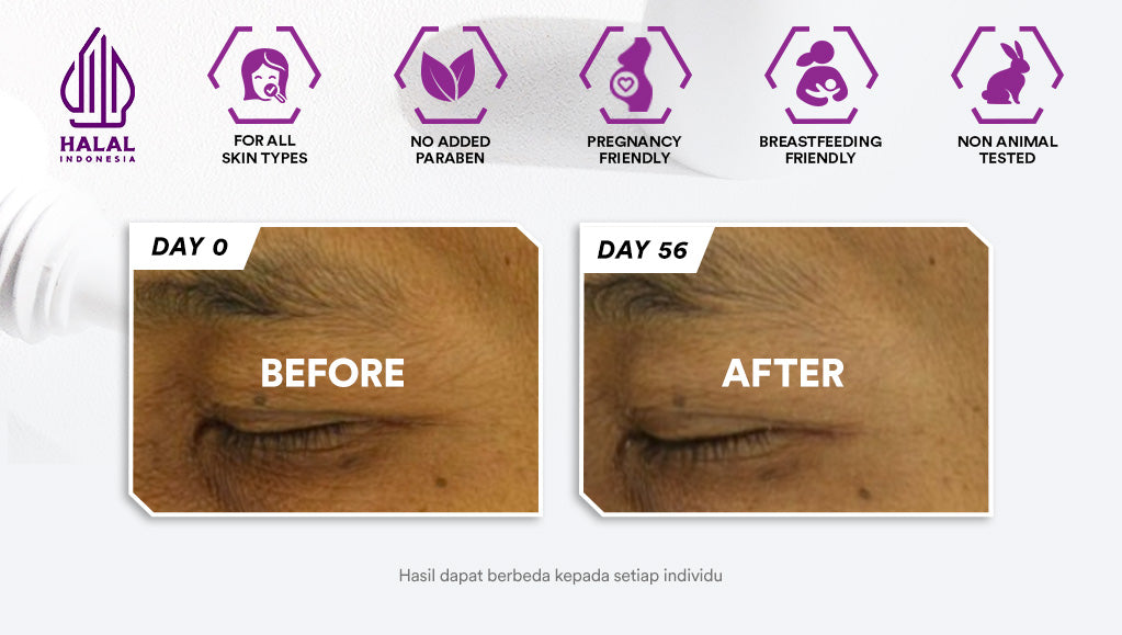 Whitelab Eye Cream - Krim Mata Atasi Kerutan, Garis Halus, Kantung Mata, dan Mata Panda dengan Peptide, Caffeine & Niacinamide [BPOM]