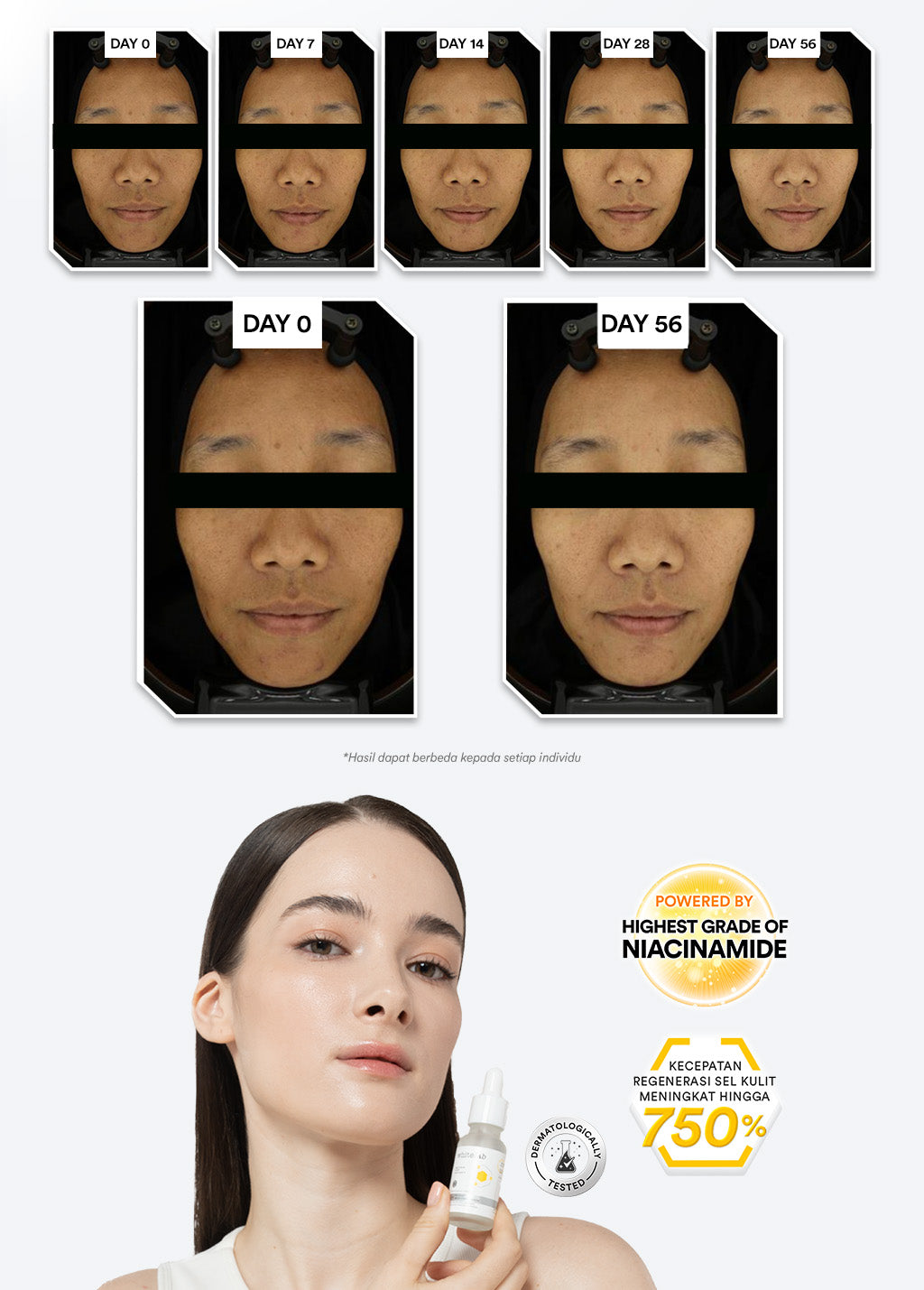 Whitelab Serum Niacinamide 5% Brightening Booster - Cerah Maksimal untuk Kulit Sensitif N5-Dose+ 2.0