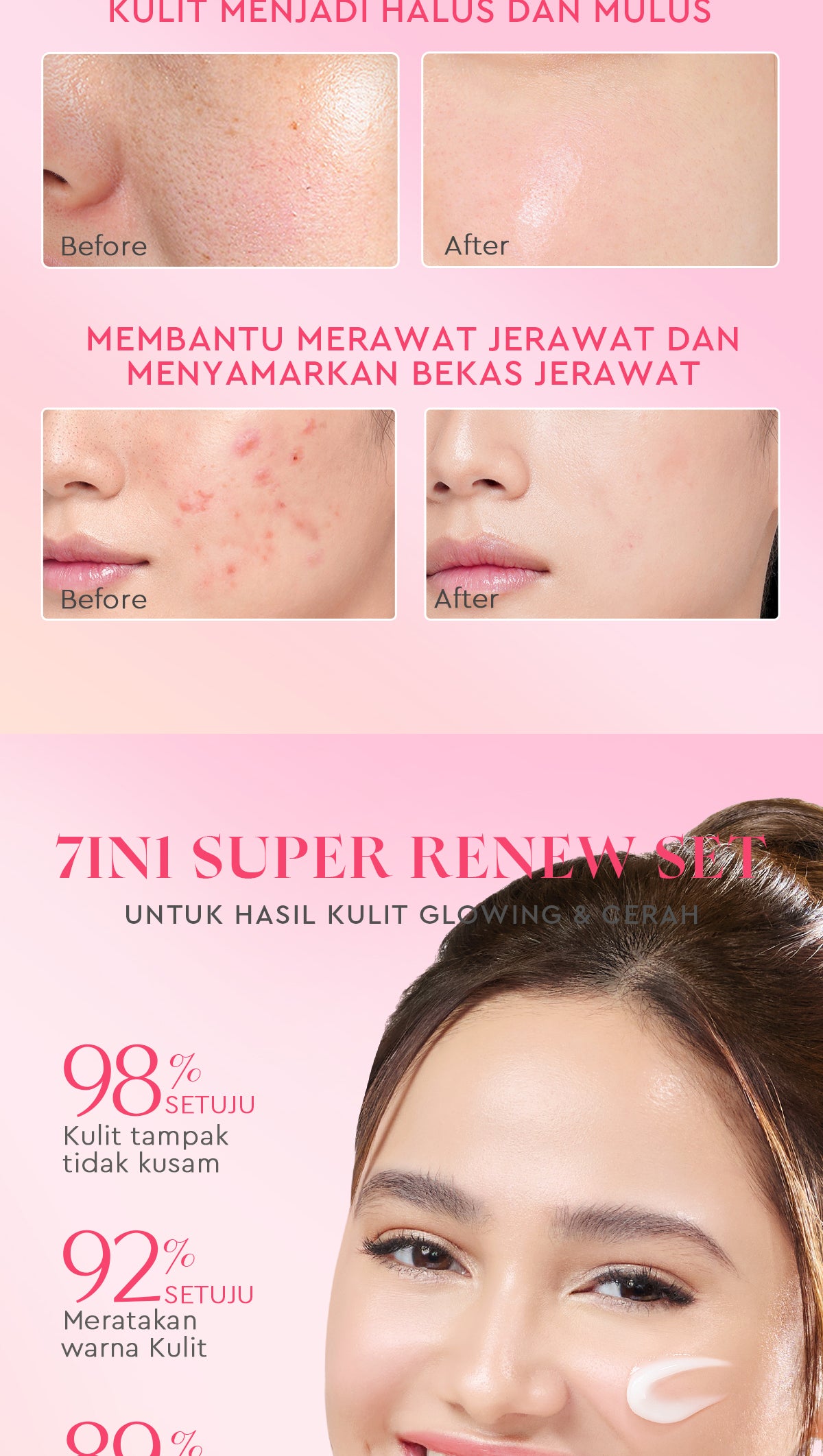 [Cocok Untuk Pemula] Glad2Glow Cerah Glowing Bundle all in 1 7in1-Brightening Moisturizer+Serum+Cleanser+toner+Peeling solution+Retinol 10%Niacinamide skincare paket pembersih perawatan kulit mencerahkan warna kulit pelembab wajah g2glow official store