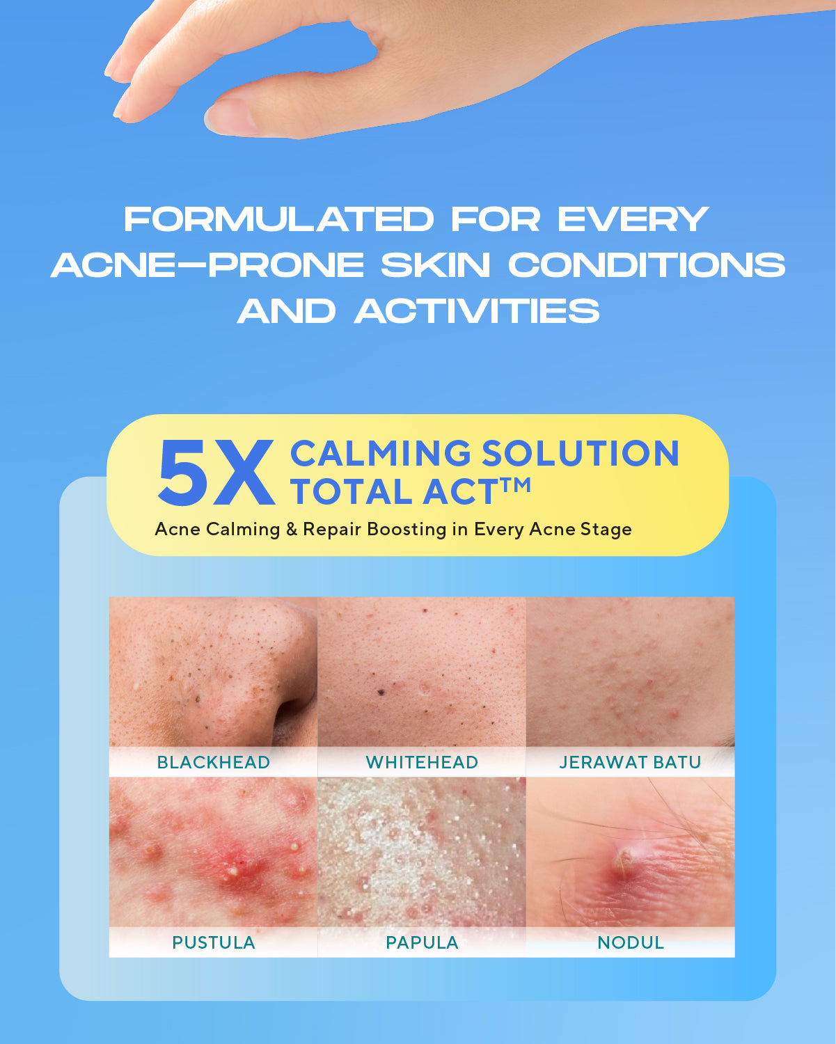 WARDAH UV Shield Acne Calming Sunscreen Moisturizer SPF 35 PA untuk komedo jerawat dan bekas jerawat kulit berminyak tekstur gel ringan mudah meresap Skincare