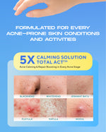 WARDAH UV Shield Acne Calming Sunscreen Moisturizer SPF 35 PA untuk komedo jerawat dan bekas jerawat kulit berminyak tekstur gel ringan mudah meresap Skincare