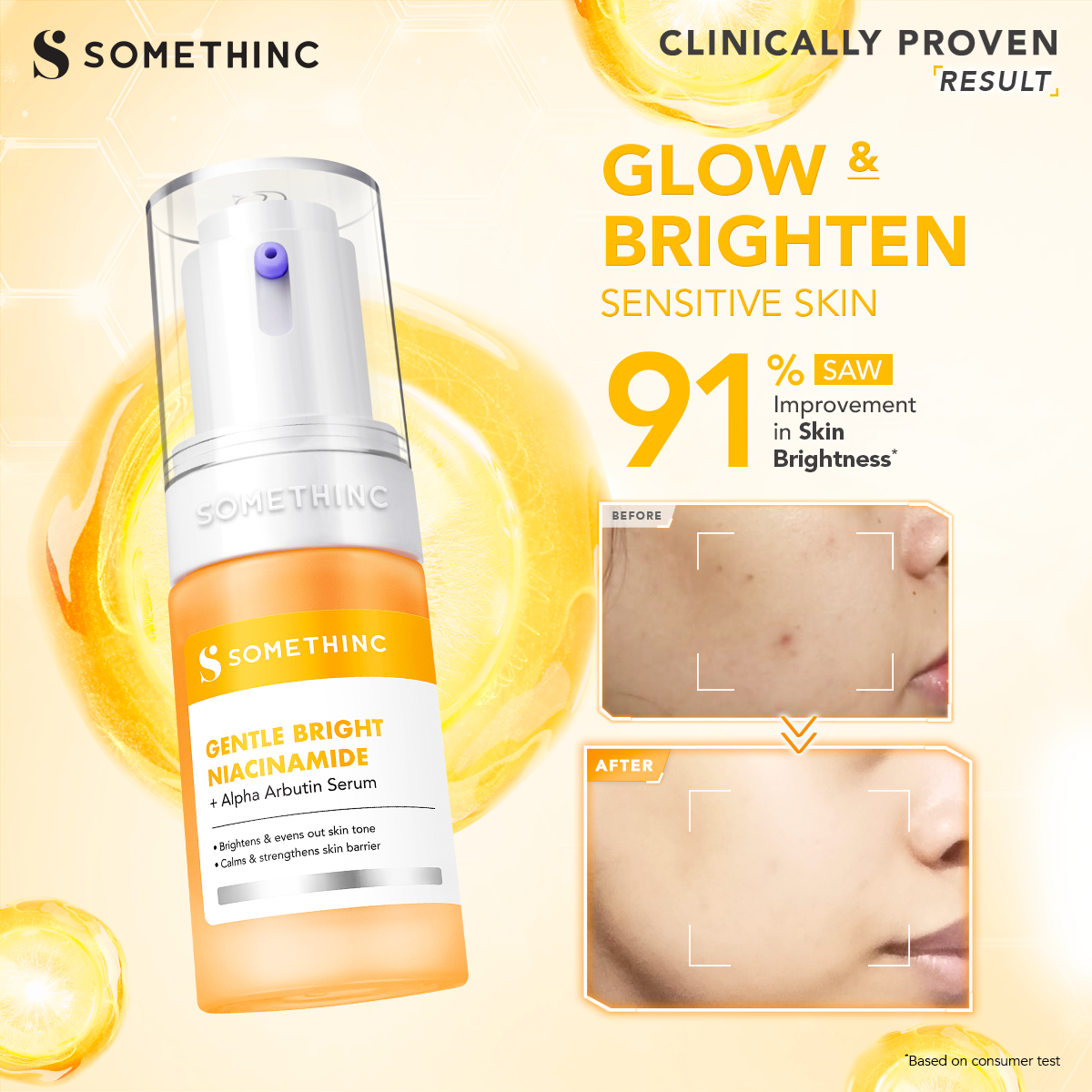 [BARU!] SOMETHINC Gentle Bright Niacinamide + Alpha Arbutin Serum - Pencerah Wajah Untuk Semua Jenis Kulit | Memperkuat Skin Barrier, Meratakan Warna Kulit, dan Memudarkan Noda Gelap & Memudarkan Pori Pori, Serum untuk Kulit Sensitif