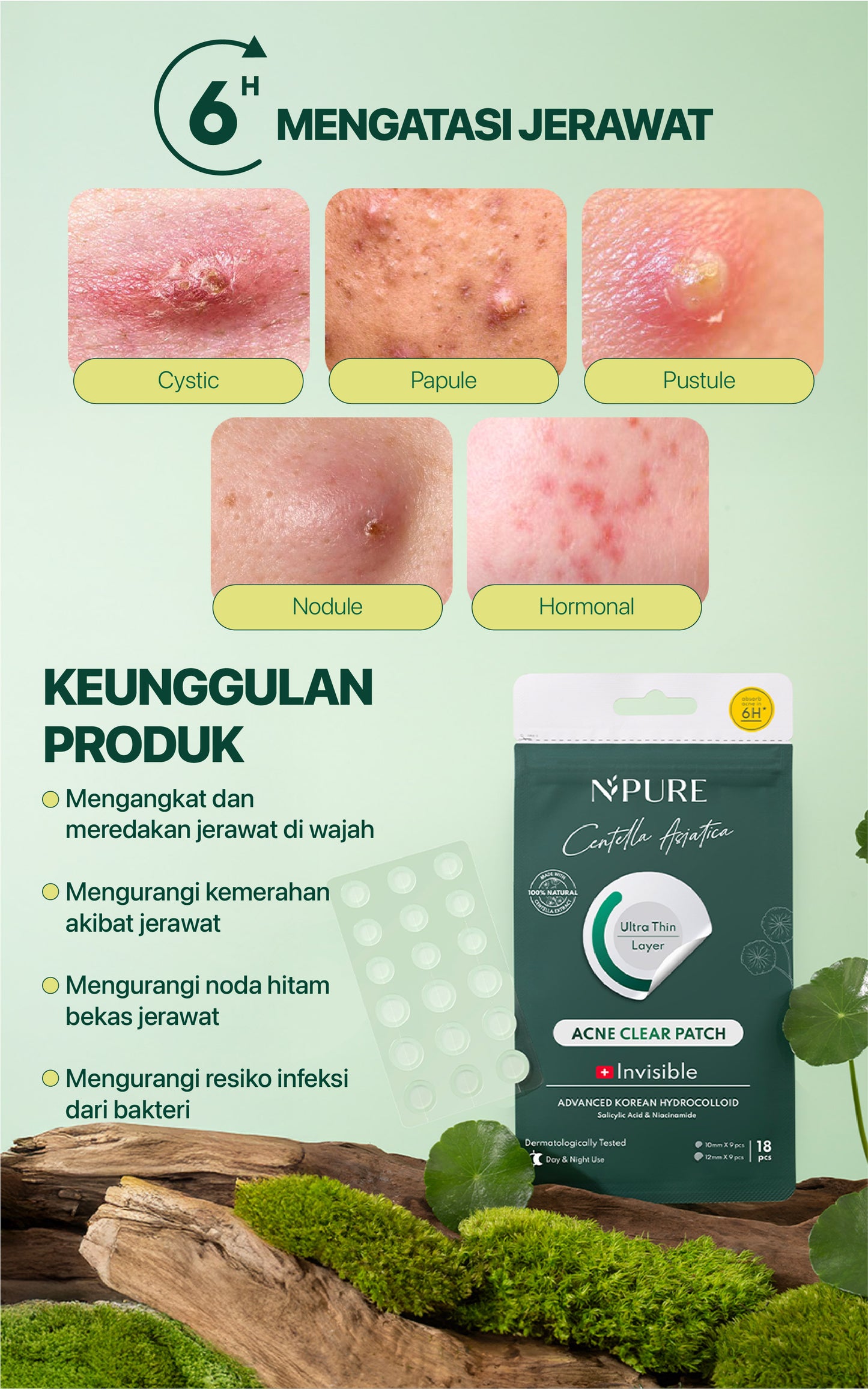 ACNE PATCH - NPURE Acne Clear Patch isi 18Pcs / Ultra thin layer / Patch Jerawat / Acne Skin / Untuk kulit Berjerawat