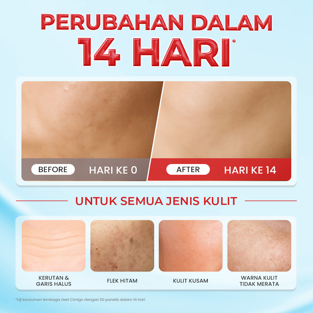 [NEW] HANASUI Gentle Retinol Moisturizer Gel 30g - Pelembab Gel Lembap & Cegah Tanda Penuaan Dini - 3 Retinol Complex - Encapsulated Retinol & HPR