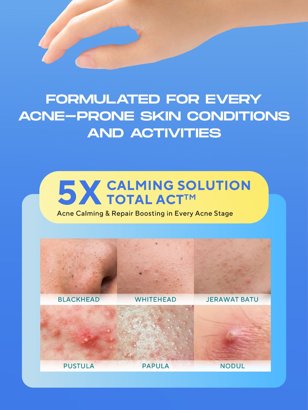 WARDAH UV Shield Acne Calming Sunscreen Serum SPF 50 PA 25ml 40 ml 100ml Sunscreen Wajah Meredakan Jerawat Ringan Mudah Meresap Calming and Repair Boosting Skincare