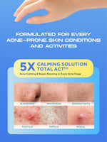 WARDAH UV Shield Acne Calming Sunscreen Serum SPF 50 PA 25ml 40 ml 100ml Sunscreen Wajah Meredakan Jerawat Ringan Mudah Meresap Calming and Repair Boosting Skincare