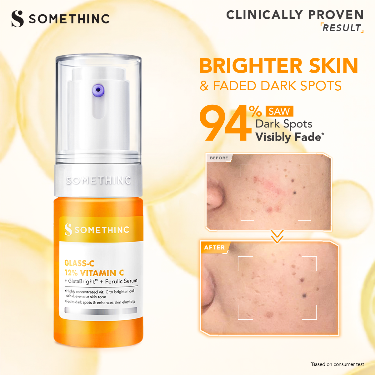 [BARU!] SOMETHINC GLASS-C 12% VITAMIN C + GlutaBright + FERULIC Serum - Mencerahkan wajah, Serum Brigthening hapus dark Spot, Age Spot & Freckles, Glowing Serum
