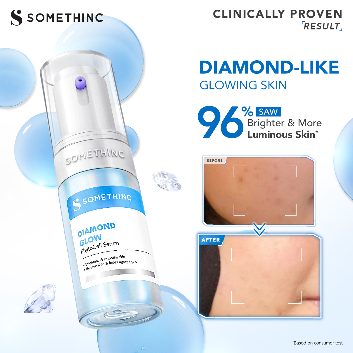 [TASYA FARASYA APPROVED] SOMETHINC Diamond Glow PyhtoCell Serum - Serum Diamond untuk Kulit Berkilau dan Cerah, Serum Brightening, Anti Aging, Serum untuk Mencegah Penuaan Dini