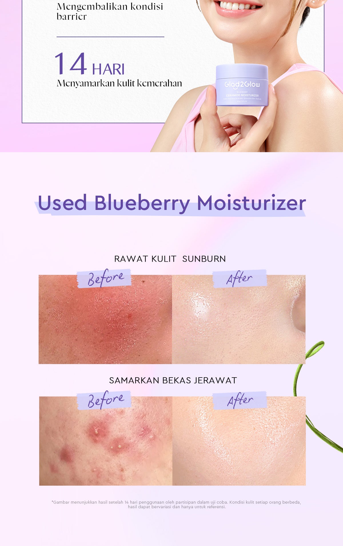 [Big Size]Glad2Glow Blueberry Moisturizer 100g 5% Ceramide Menjaga Skin Barrier Perawatan Wajah Mencerahkan wajah Menjaga kelembapan kulit Penyerapan cepat Pelembab wajah Esensi wajah Produk perawatan kulit Perawatan wajah g2glow official store