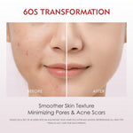 ELFORMULA Intensive Peeling Solution - Peeling Serum Dark Spot Glass Skin Eksfoliasi Wajah Mengangkat Sel Kulit Mati AHA BHA PHA Glowing Smooth Skin Mencerahkan Kulit Halus Blackhead Brightening Whitening Exfoliasi Exfoliating