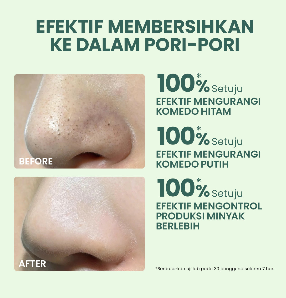 YOU AcnePlus Oil Control Clay Mask Masker Jerawat Masker Komedo Kulit Berminyak Bebas Jerawat