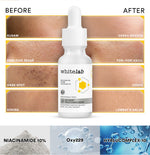 Whitelab Serum Niacinamide 10% Brightening - Serum Pencerah Wajah Intensif N10-Dose+ 2.0