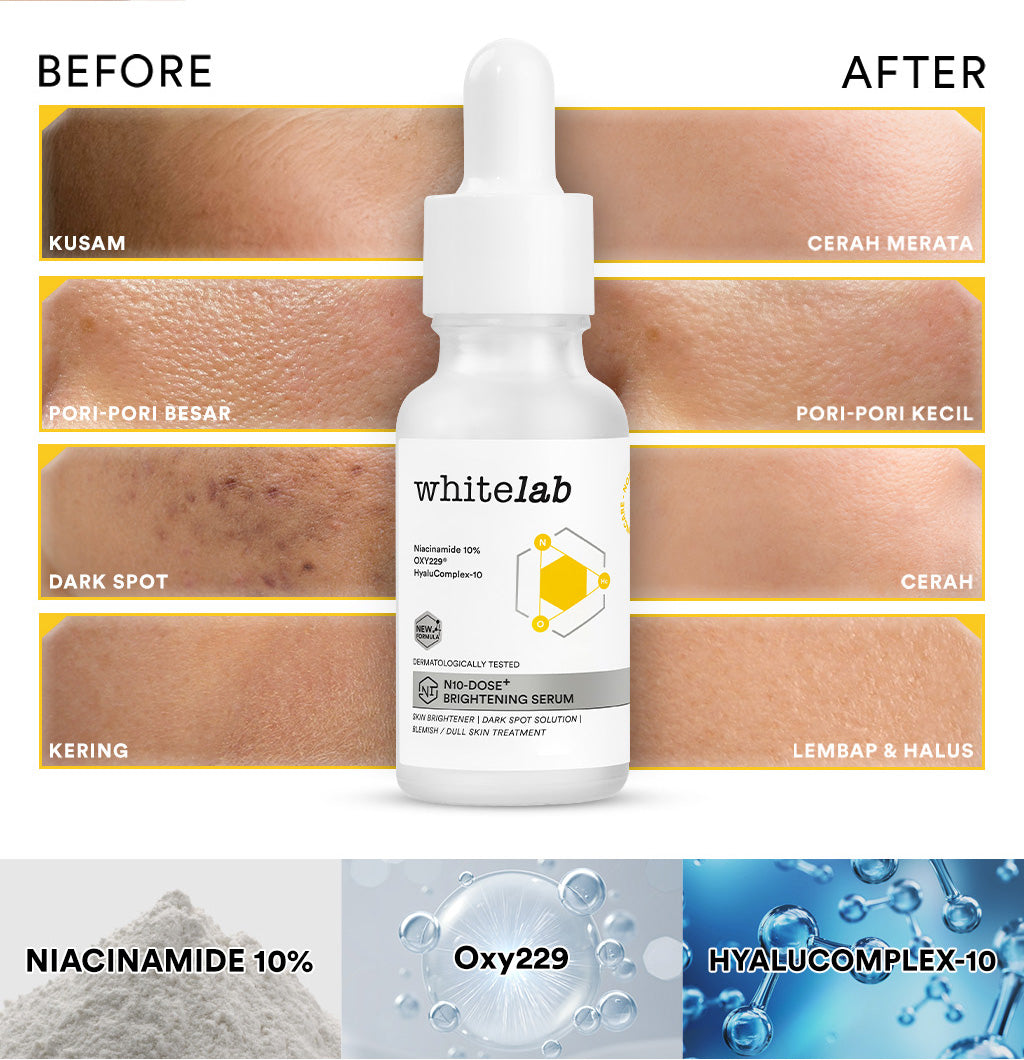 Whitelab Serum Niacinamide 10% Brightening - Serum Pencerah Wajah Intensif N10-Dose+ 2.0
