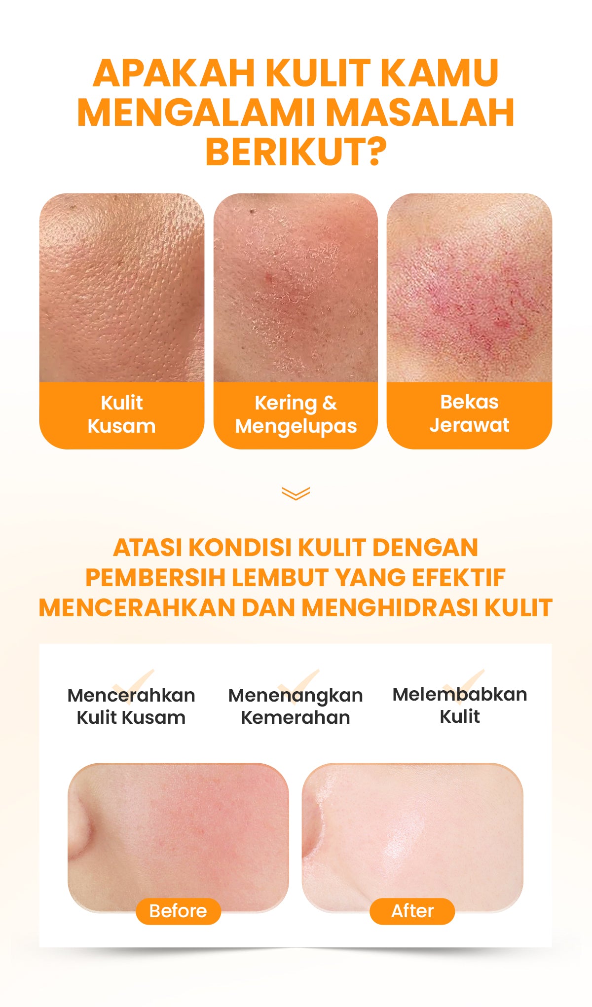 YOU Hy! Amino Glo-Win Brightening Facial Wash Mencerahkan Niacinamide Glowing Skin