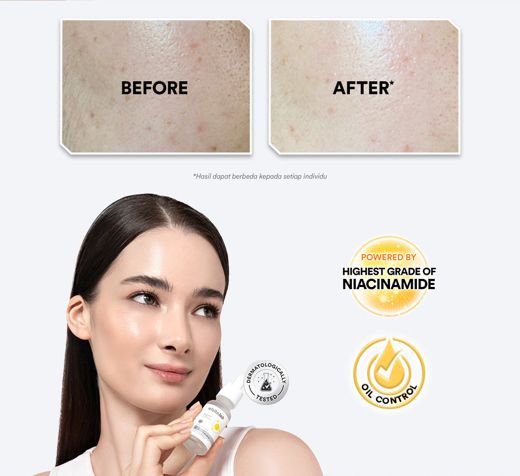 [UPGRADED FORMULA] Whitelab N10-Dose+ Intense Brightening Serum Niacinamide 10% - Serum Pencerah Wajah Intensif Dengan Niacinamide, Oxy229, & Hyaluronic [BPOM]]