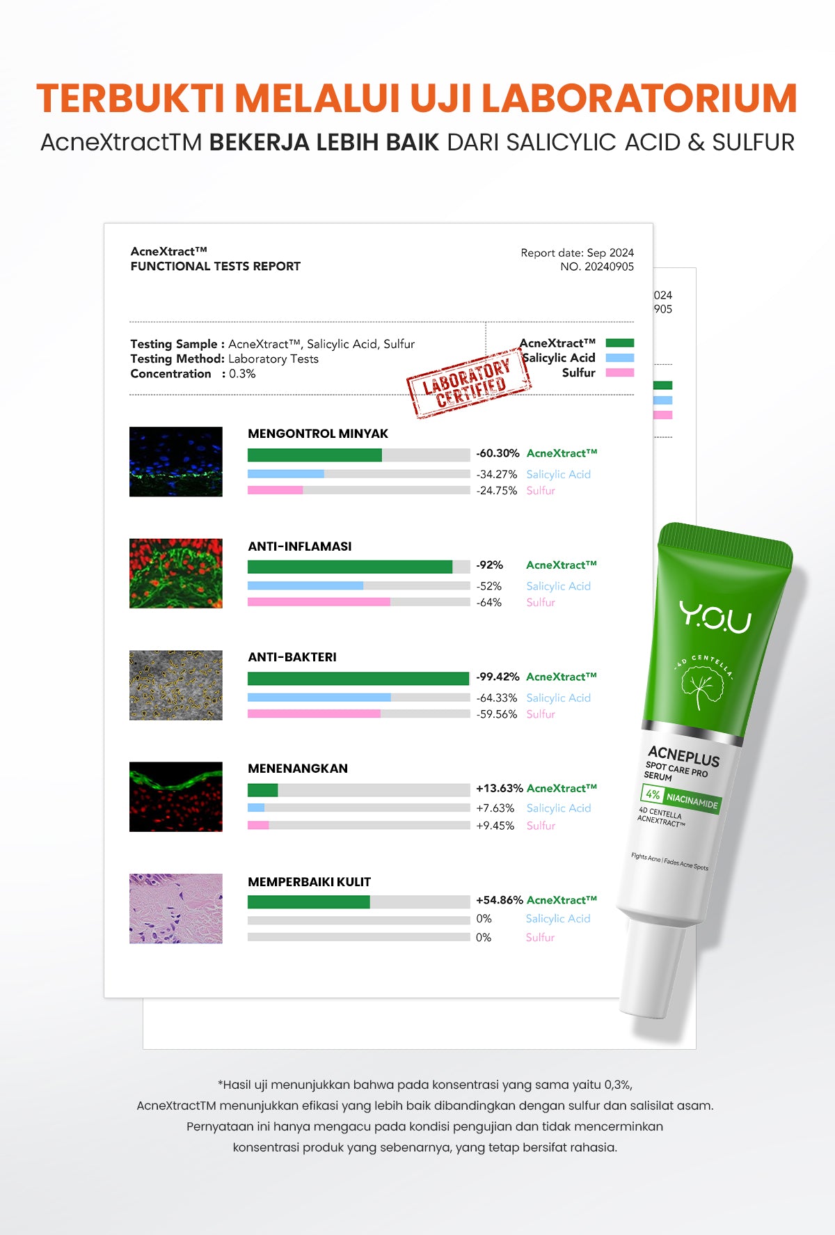 [NEW UPGRADED] YOU AcnePlus Spot Care Pro Serum Obat Totol Jerawat B5 Barrier Moisturizer Gel Obat Bekas Jerawat Kulit Sensitif Kulit Berjerawat [Hot Selling]