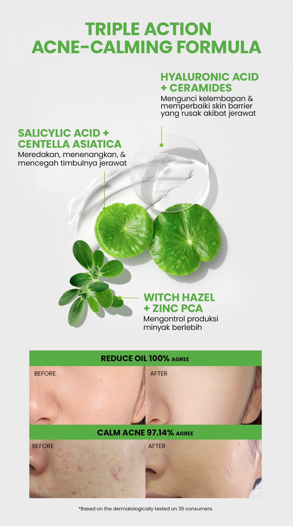 YOU Sunbrella Pro Acnecare Shield Sunscreen SPF 50+ PA++++ Acne Sunscreen Skincare  Collection Sunscreen Acne Prone Skin Melindungi dari Jerawat dan Sinar UV