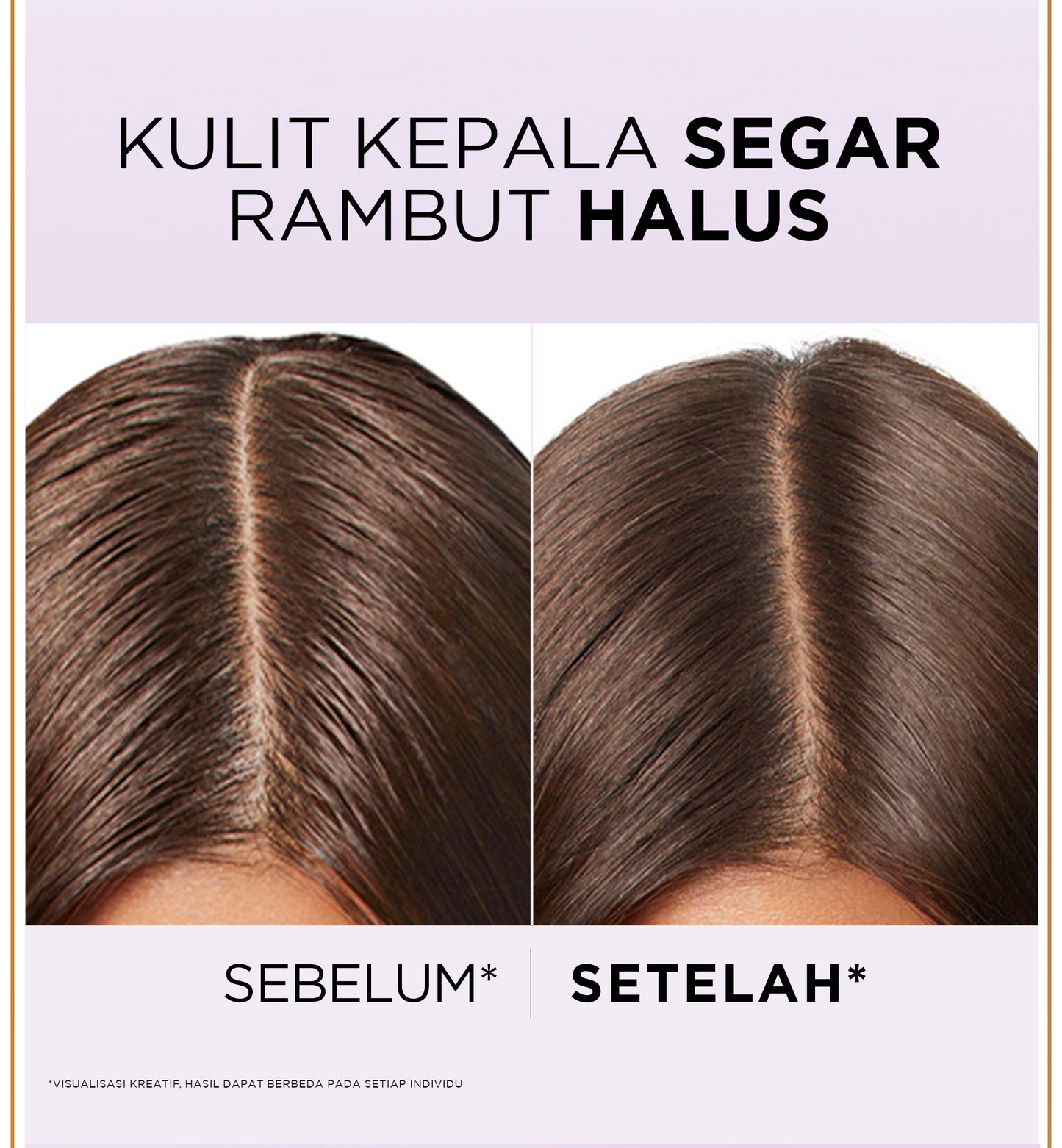 [BARU] L'Oreal Paris Hyaluron Pure 72H Rehydrating Conditioner - Perawatan Rambut Bebas Lepek dan Rambut Halus tahan hingga 72jam -  265ml - Kulit Kepala Berminyak dan Rambut Kering