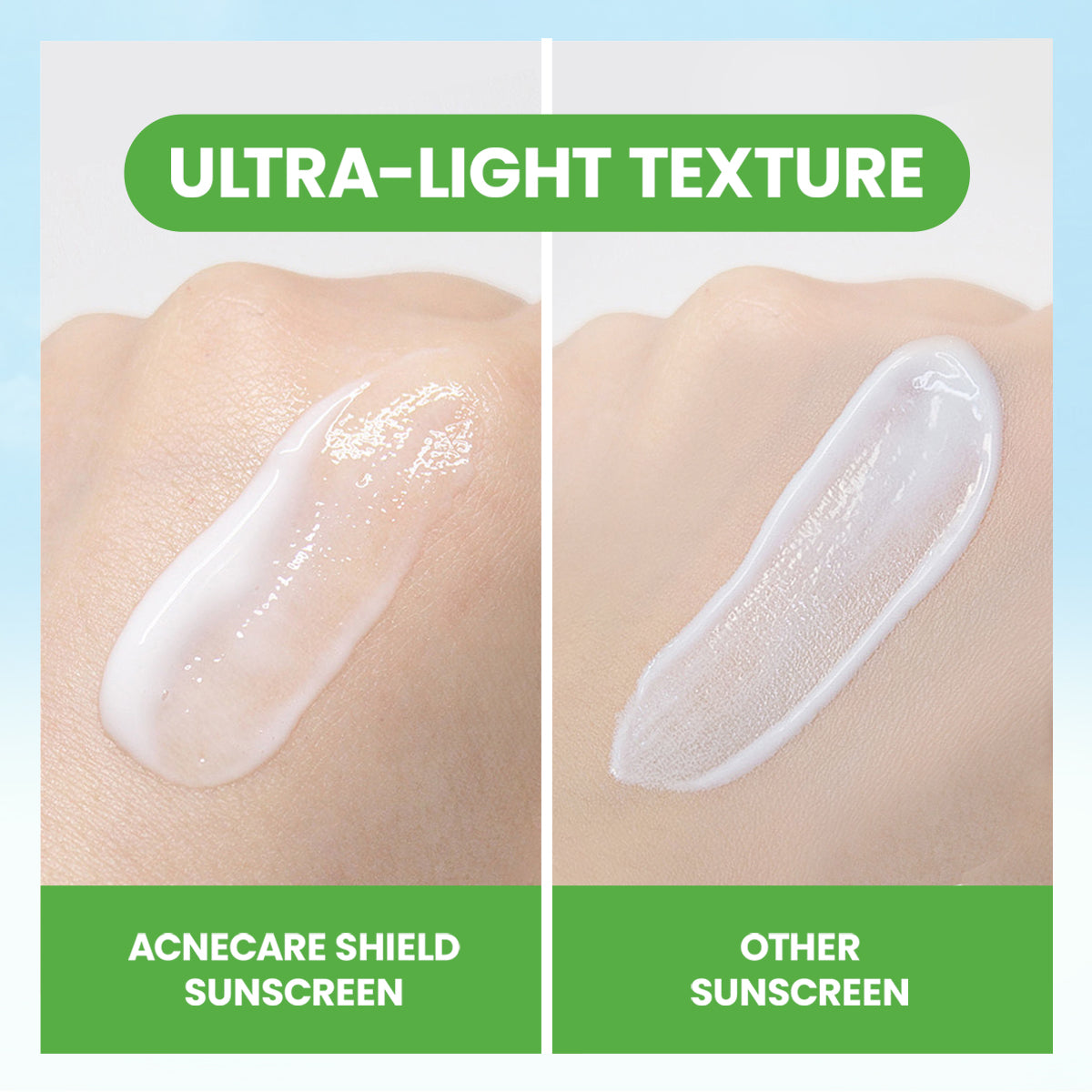 YOU Sunbrella Pro Acnecare Shield Sunscreen SPF 50+ PA++++ Acne Sunscreen Skincare  Collection Sunscreen Acne Prone Skin Melindungi dari Jerawat dan Sinar UV