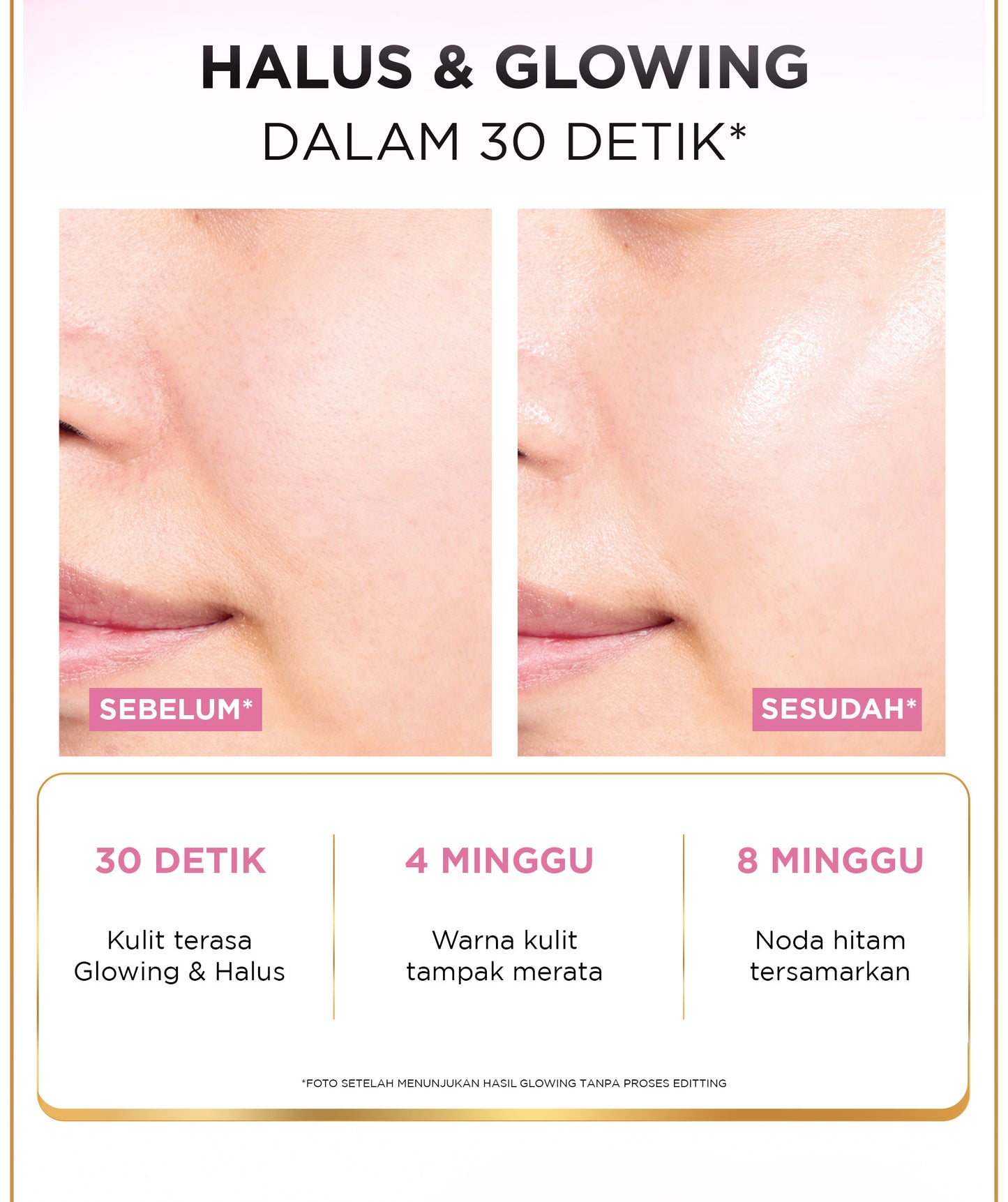 L’Oreal Paris Glycolic Bright Peeling Toner - 25 (Kulit Cerah, Halus dan Glowing dalam 30 detik)  Kulit Kusam, Noda Hitam, Bekas Jerawat, Eksfoliasi  Brightening