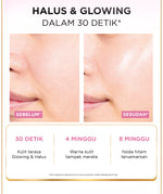 L’Oreal Paris Glycolic Bright Peeling Toner - 25 (Kulit Cerah, Halus dan Glowing dalam 30 detik)  Kulit Kusam, Noda Hitam, Bekas Jerawat, Eksfoliasi  Brightening