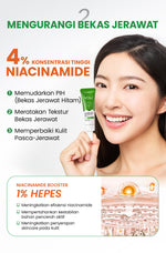 [NEW UPGRADED] YOU AcnePlus Spot Care Pro Serum Obat Totol Jerawat B5 Barrier Moisturizer Gel Obat Bekas Jerawat Kulit Sensitif Kulit Berjerawat [Hot Selling]