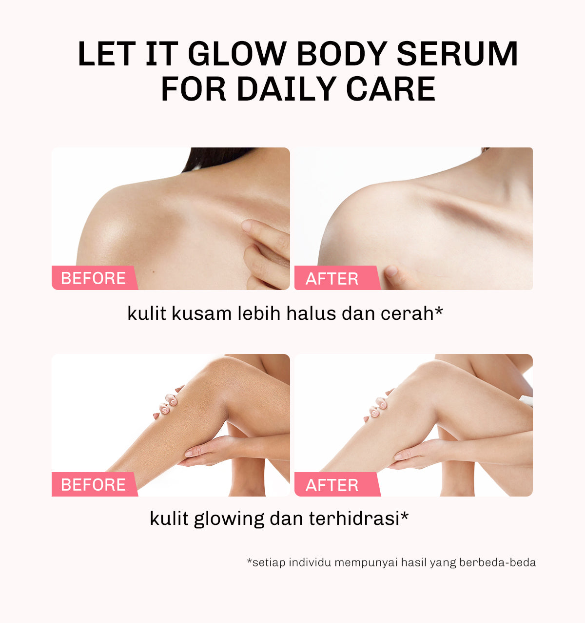 Lavojoy Let It Glow Black Opium Body Serum Skin Brightening Upgraded Version | Body Lotion Untuk Mencerahkan Dan Melembabkan Kulit Dengan Niacinamide + Ceramide + Vitamin E