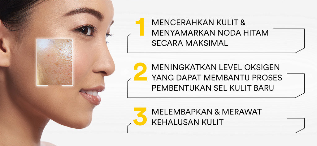 Whitelab Serum Niacinamide 10% Brightening - Serum Pencerah Wajah Intensif N10-Dose+ 2.0