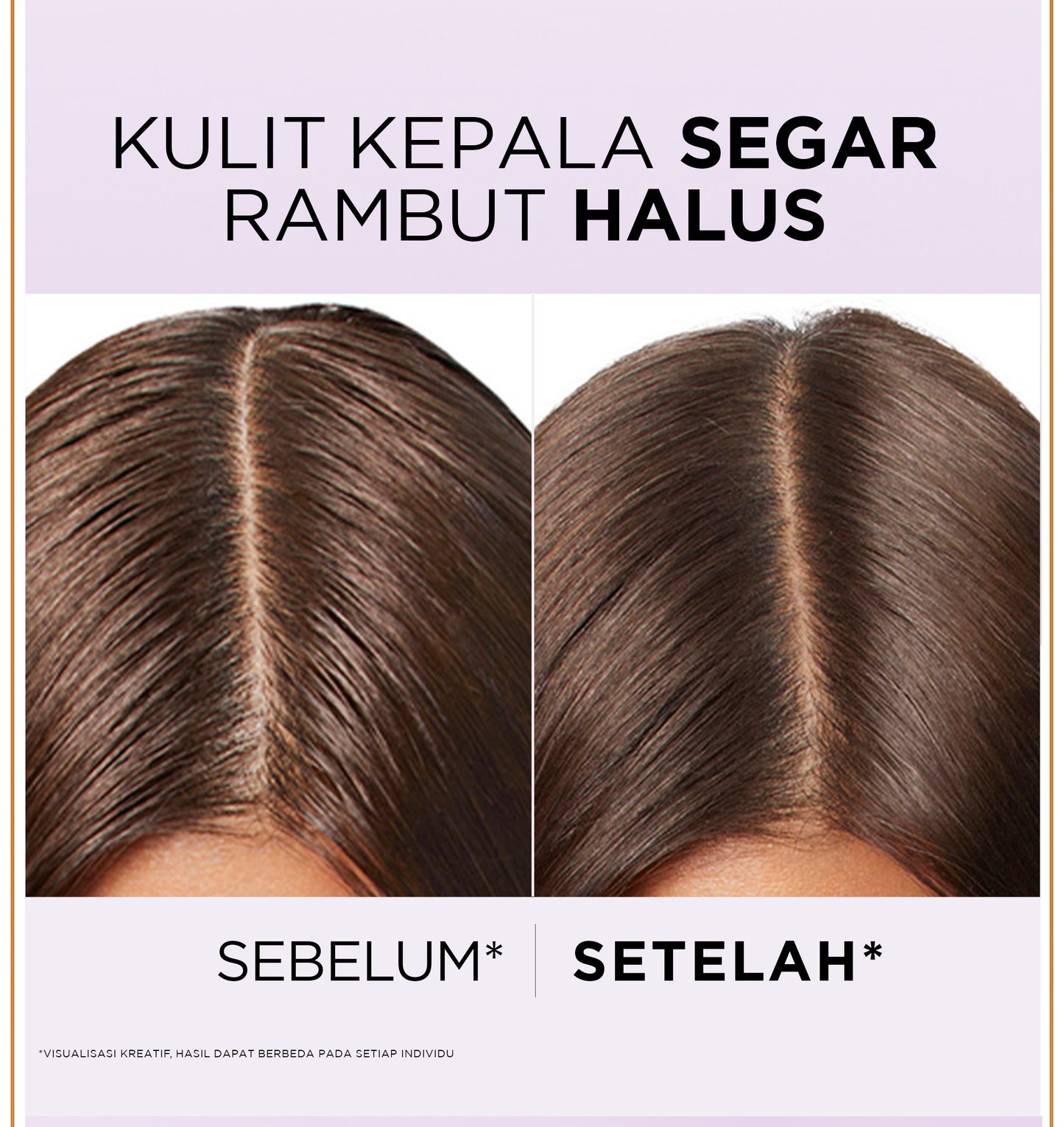 [BARU] L'Oreal Paris Hyaluron Pure 72H Purifying Shampoo - Perawatan Rambut Bebas Lepek dan Rambut Halus tahan hingga 72jam - Shampoo 280ml - Kulit Kepala Berminyak dan Rambut Kering