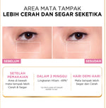L'Oreal Paris Glycolic Bright Dark Circle Eye Serum 20ml Aplikator Boba - Skincare untuk Samarkan Mata Panda dengan Niacinamide