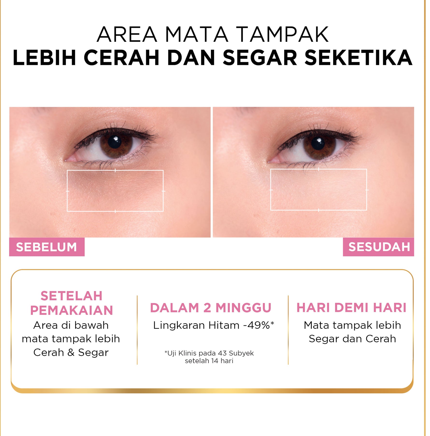 L'Oreal Paris Glycolic Bright Dark Circle Eye Serum 20ml Aplikator Boba - Skincare untuk Samarkan Mata Panda dengan Niacinamide