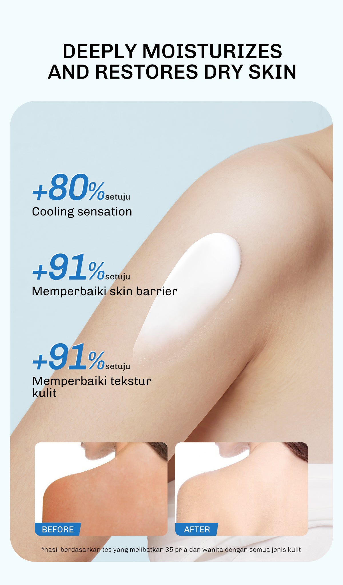 Lavojoy Keep It Chill Body Serum 180ml | Calm Down And Hydrate Skin | Body Lotion | Sensasi Dingin | Menenangkan Kulit | Memperkuat Skin Barrier | Ceramide + Centella Asiatica + Mint Extracts