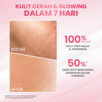 [Special Package] Hanasui Double Expert, Glow Better Set 4 pcs + Power Bright Expert Serum - Real 10% Advance Nianicinamide Menyamarkan Bintik Hitam Bekas Jerawat New Improved Formula