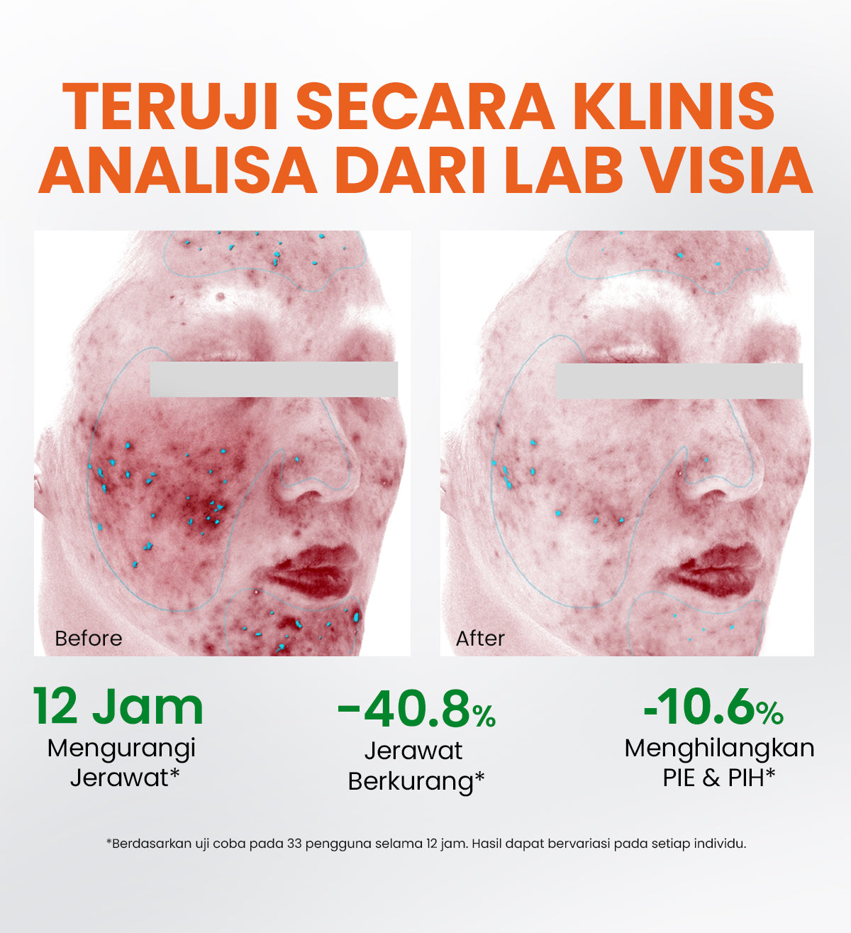[NEW UPGRADED] YOU AcnePlus Spot Care Pro Serum Obat Totol Jerawat B5 Barrier Moisturizer Gel Obat Bekas Jerawat Kulit Sensitif Kulit Berjerawat [Hot Selling]