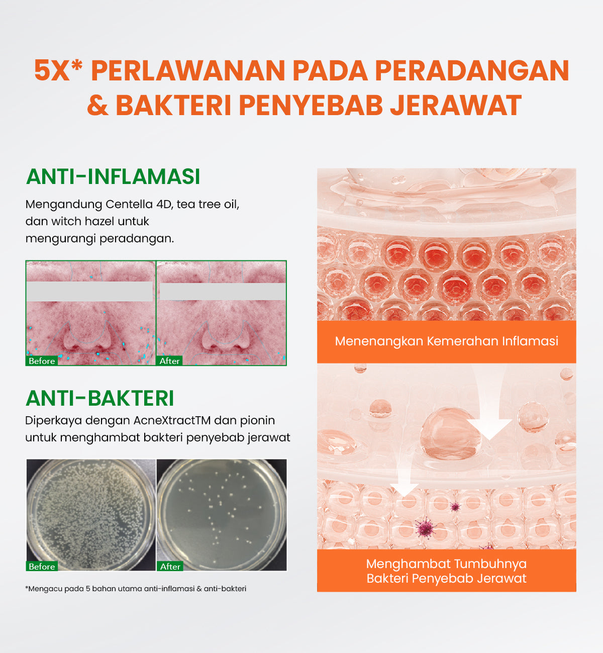 [NEW UPGRADED] YOU AcnePlus Spot Care Pro Serum Obat Totol Jerawat B5 Barrier Moisturizer Gel Obat Bekas Jerawat Kulit Sensitif Kulit Berjerawat [Hot Selling]