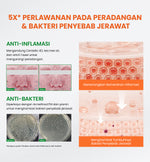 [NEW UPGRADED] YOU AcnePlus Spot Care Pro Serum Obat Totol Jerawat B5 Barrier Moisturizer Gel Obat Bekas Jerawat Kulit Sensitif Kulit Berjerawat [Hot Selling]