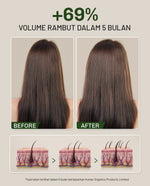 [LIVE] Lavojoy Hold Me Tight Pro Shampoo Spring Wonder Hair Fall Care | Hair Shampoo | Sampo Rambut | Shampoo Perawatan Rambut Rontok | Mempercepat Pertumbuhan Rambut | Mengurangi Kerontokkan | Sampo Ginseng & Jahe