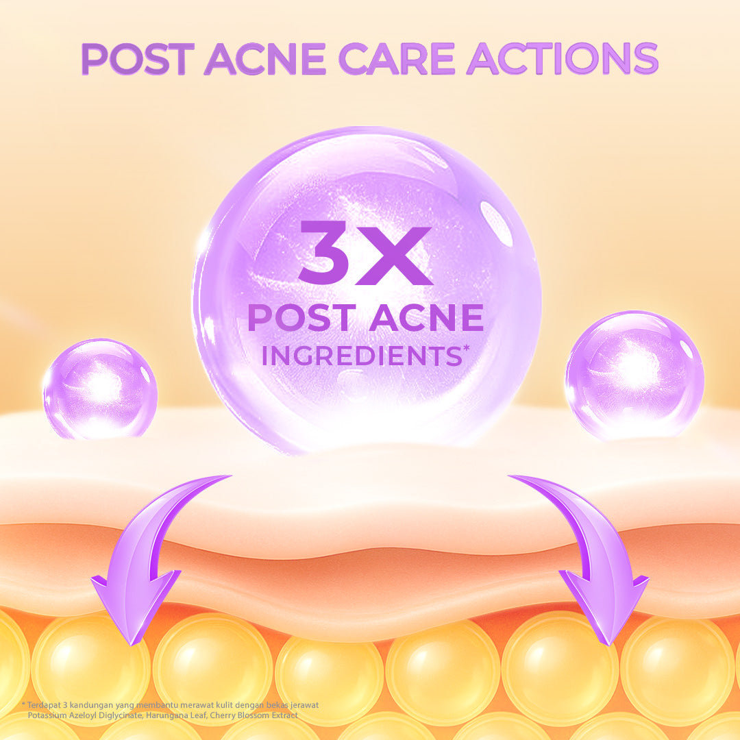 Hanasui Power Post Acne Serum - Pudarkan Bekas Jerawat PIE & PIH Mencerahkan dan Kurangi Kemerahan Cegah Jerawat Kembali