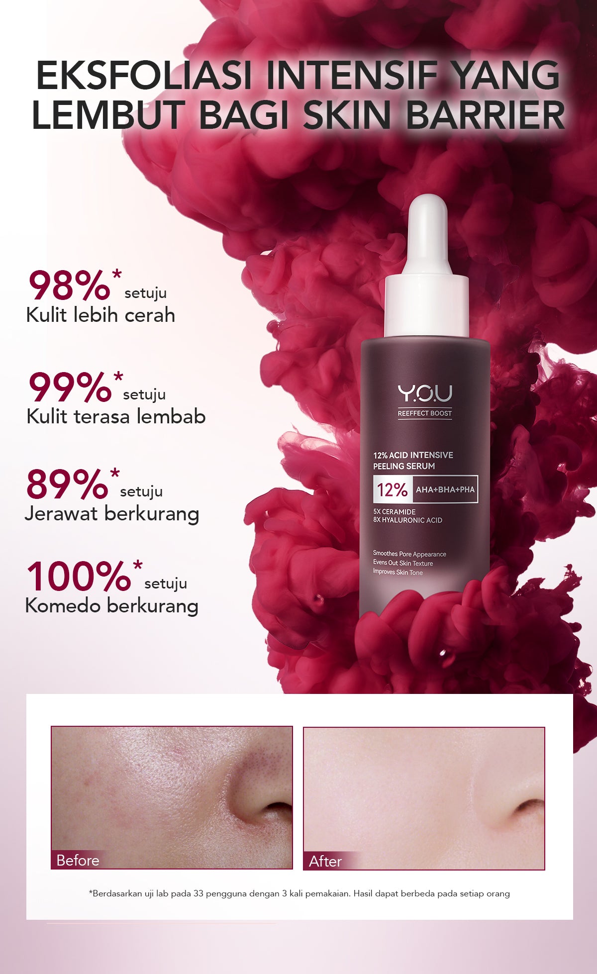 YOU 12% ACID INTENSIVE PEELING SERUM 1.5ML*5 [TRAVEL SIZE] | AHA BHA PHA |Eksfoliasi Kulit Cerah Halus | Pori Besar