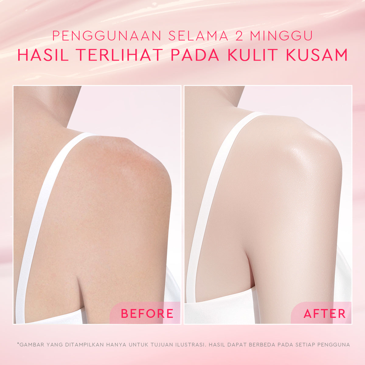 Glad2Glow Bright & Moist Body Serum Series | Body Cream Body Lotion Brighten Moist & Smooth Pemutih Badan Body Serum Glow & Peeling Menghidrasi Kulit Mencerahkan Dan Pemutih Tubuh Atasi Belang Brighty Care Whiten Handbody ohbt Lotion g2g official store