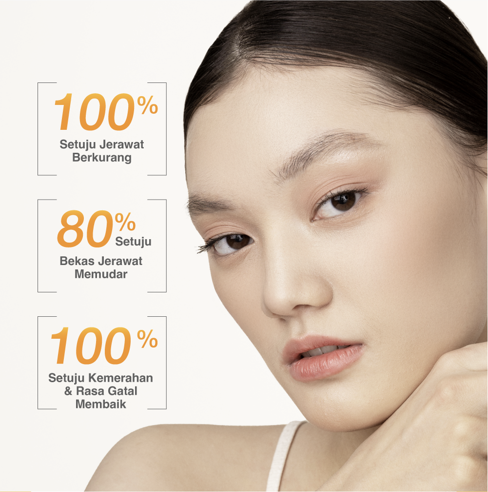 NEWLAB Acnalogy Boost || Acne Supplement || Minuman untuk Pereda Jerawat dan Bekasnya || Obat Jerawat dan Bruntusan 50gr
