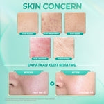 【BIG SIZE】Hanasui Ceramide Probiotics Moisturizer Gel 100ml - Pelembab Ringan Lembap Perbaiki Skin Barrier dan Mencerahkan