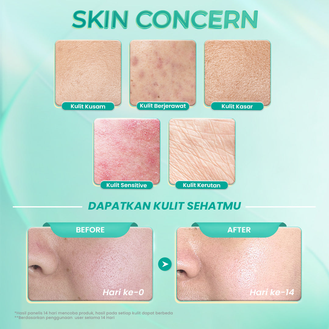 【BIG SIZE】Hanasui Ceramide Probiotics Moisturizer Gel 100ml - Pelembab Ringan Lembap Perbaiki Skin Barrier dan Mencerahkan