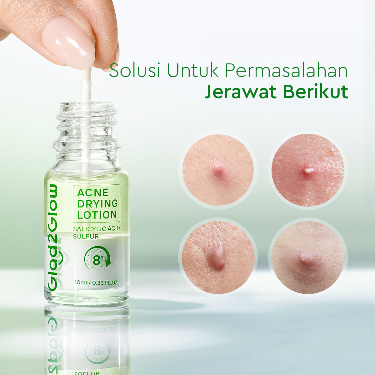GLAD2GLOW Acne Drying Lotion Mengeringkan Jerawat 8 Jam Dengan Sulfur BHA & Bahan Alami Instant Acne Care Acne Gel Patch Spot Jerawat Serum Moisturizer Acne Skincare Wajah face wash facial Salicylic Acid Niacinamide g2glow official store
