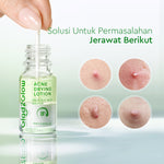 GLAD2GLOW Acne Drying Lotion Mengeringkan Jerawat 8 Jam Dengan Sulfur BHA & Bahan Alami Instant Acne Care Acne Gel Patch Spot Jerawat Serum Moisturizer Acne Skincare Wajah face wash facial Salicylic Acid Niacinamide g2glow official store