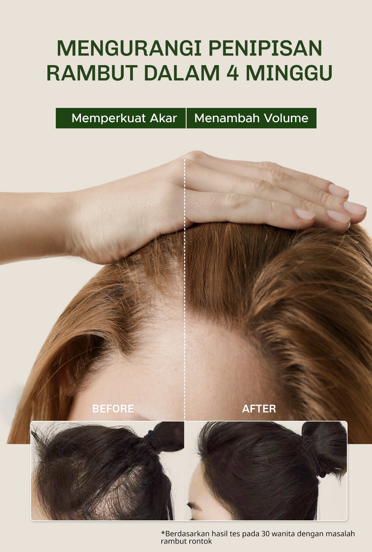 Lavojoy Hold Me Tight Pro Scalp Essence Spring Wonder | Hair Shampoo | Shampo Rambut | Mengatasi Rambut Rontok Kebotakan | Perawatan Rambut Rontok | Memperkuat Akar Rambut | Perawatan Rambut Rontok Essence | Hair Tonic | Essence Ginseng & Jahe