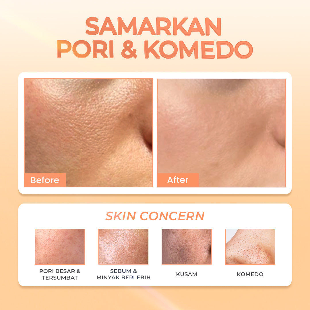 Hanasui Power Mini Pore Serum - Kurangi Komedo & Kontrol Minyak Berlebih Pori tersumbat Salicylic Acid