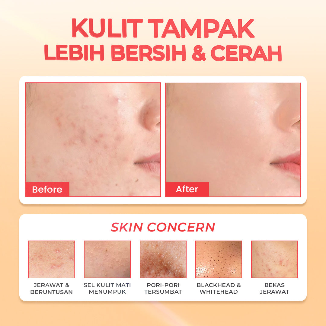 Hanasui Power Peeling Serum -  Eksfoliasi Wajah Mencerahkan, Angkat Sel Kulit Mati Komedo, Kulit Tidak Iritasi Kering